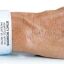Wristbands for Patients
